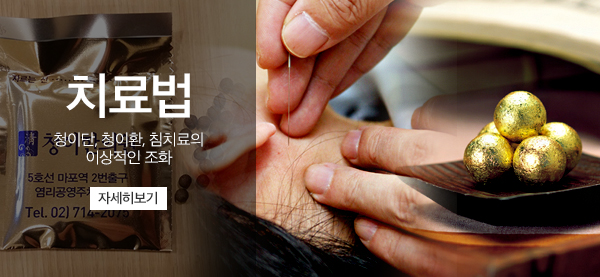 치료법